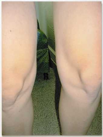 an image of a woman's knees standing in an interior space.